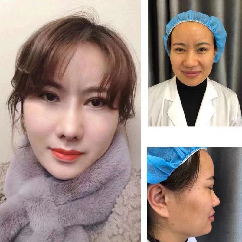 双眼皮、下眼袋、切眉提眉微整形培训机构 双眼皮、下眼袋、切眉提眉微整形培训机构