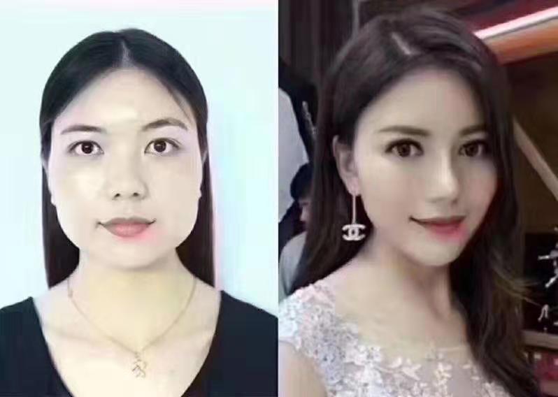 双眼皮、下眼袋、切眉提眉微整形培训机构 双眼皮、下眼袋、切眉提眉微整形培训机构