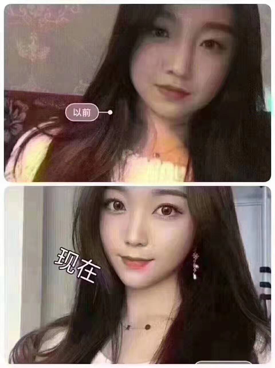 武汉市江夏区学习台式微整形哪里做的比较好 武汉市江夏区学习台式微整形哪里做的比较好